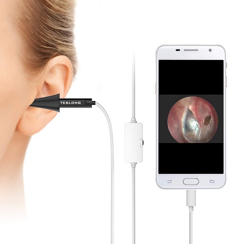 Teslong Digital Otoscope